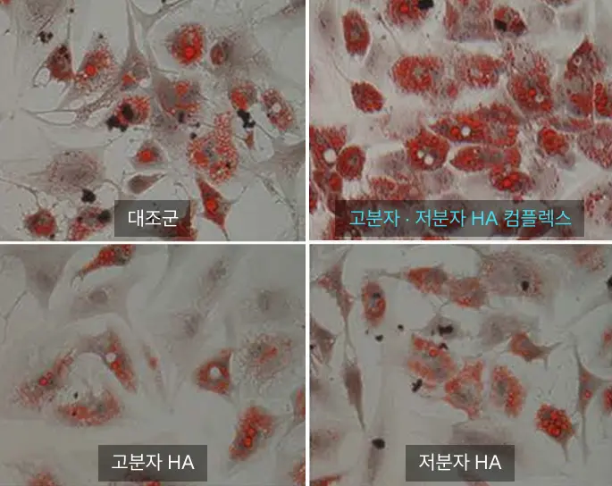 HiloWave Low-Molecular-Weight Hyaluronic Acid Effect on Adipocyte Proliferation