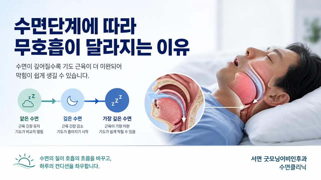 부산수면무호흡 | 수면단계에 따라 무호흡이 달라지는 이유는 무엇인가요?