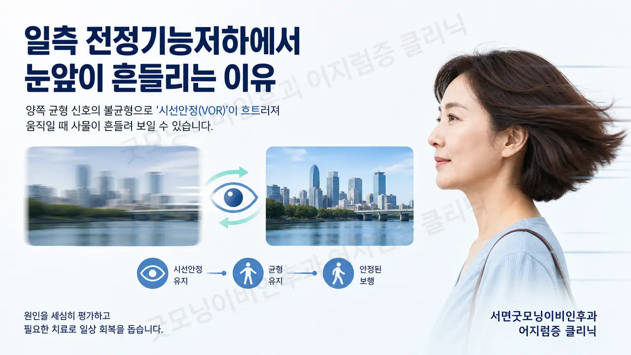 부산어지럼증 | 일측 전정기능저하에서 눈앞이 흔들리는 이유는 무엇인가요?