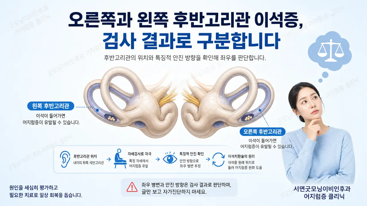 부산 이석증 | 오른쪽과 왼쪽 후반고리관 이석증은 어떻게 구분하나요?