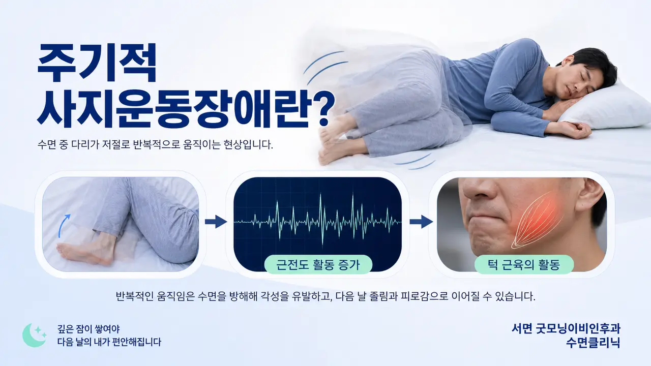 부산 수면클리닉 | 주기적 사지운동장애는 무엇인가요?