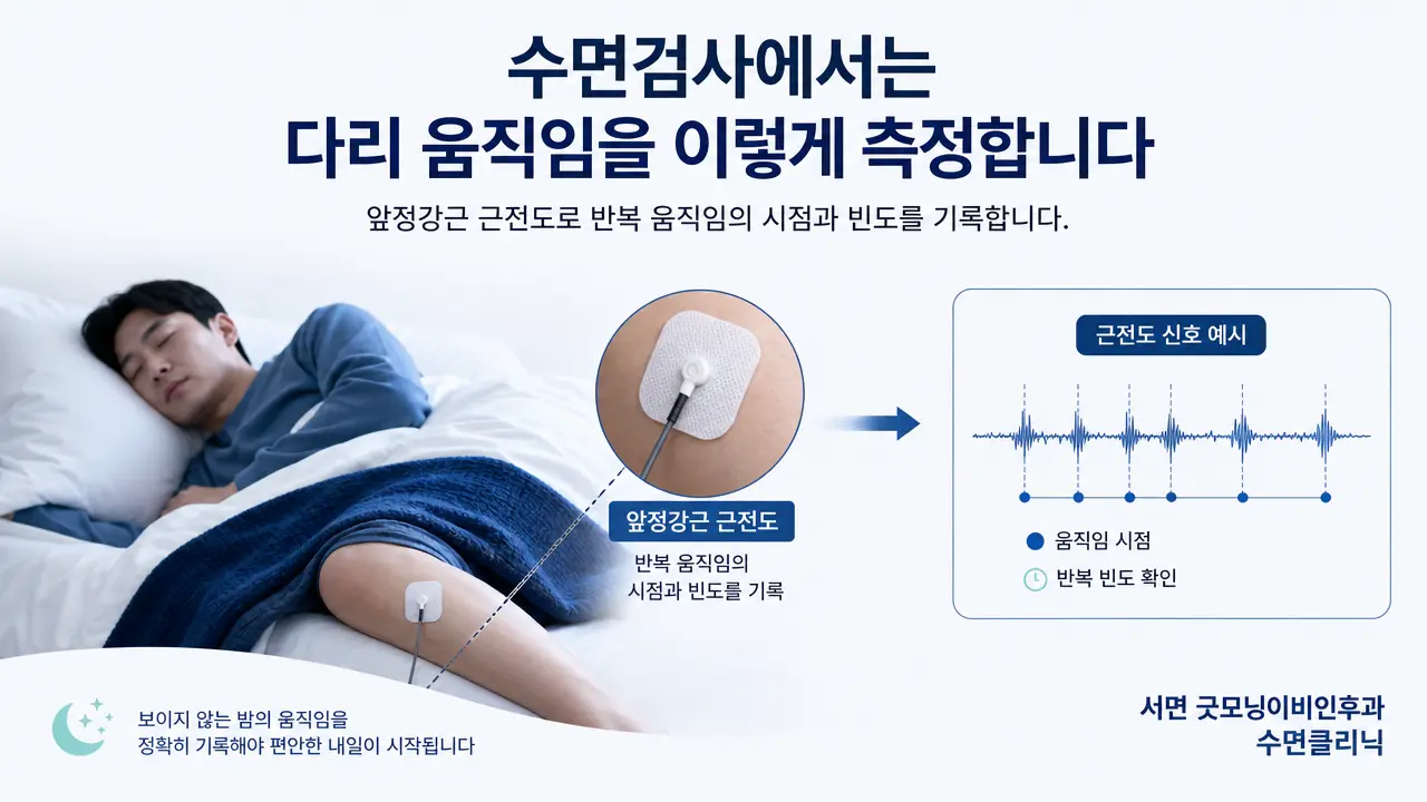 부산수면다원검사 | 수면검사에서는 다리 움직임을 어떻게 측정하나요?