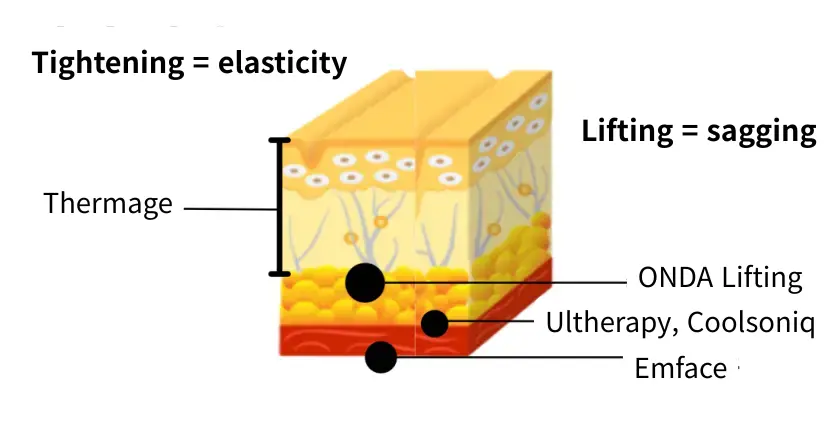 Tightning = Elasticity / Lifting = Sagging