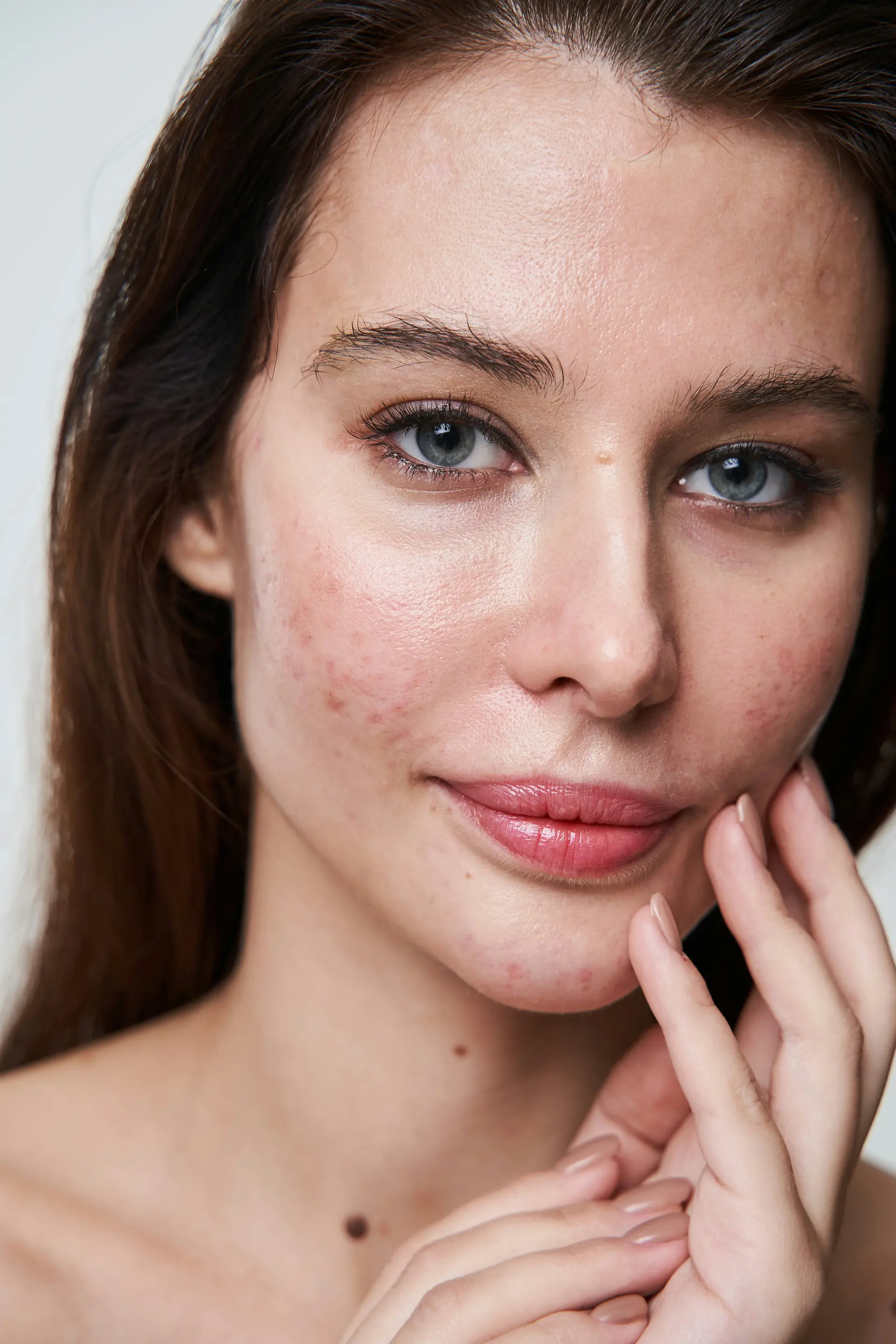 アグネス（AGNES）