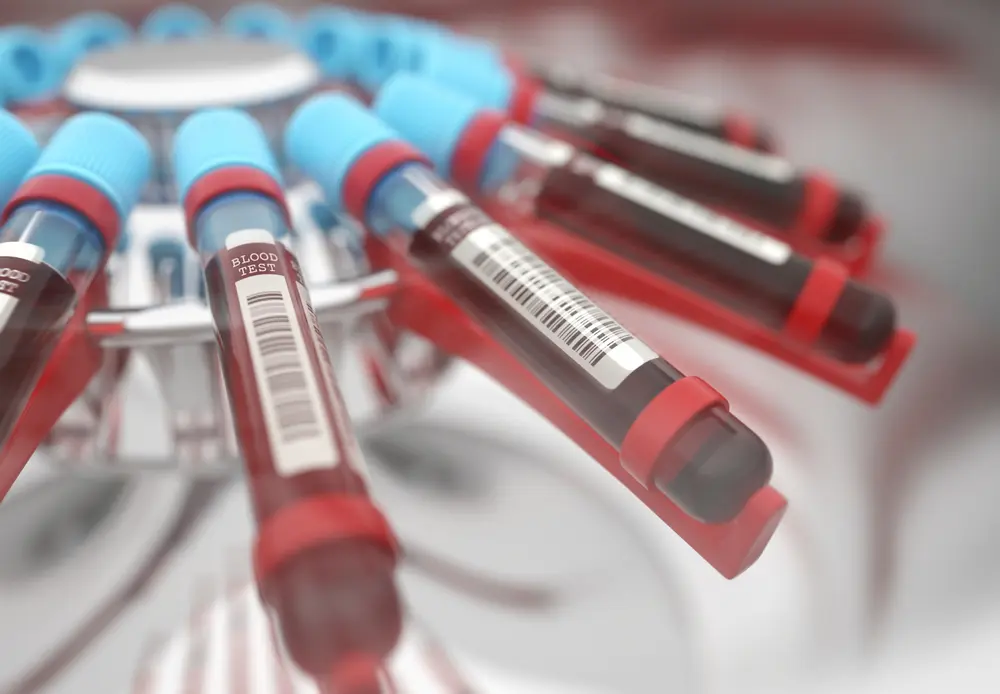 암요양병원 찾기 | 힐링오아시스