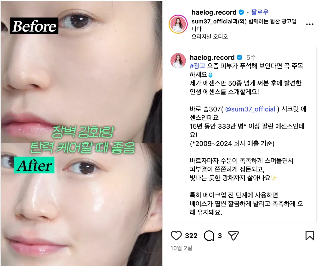 명확한 B/A를 보여주는 콘텐츠 구조