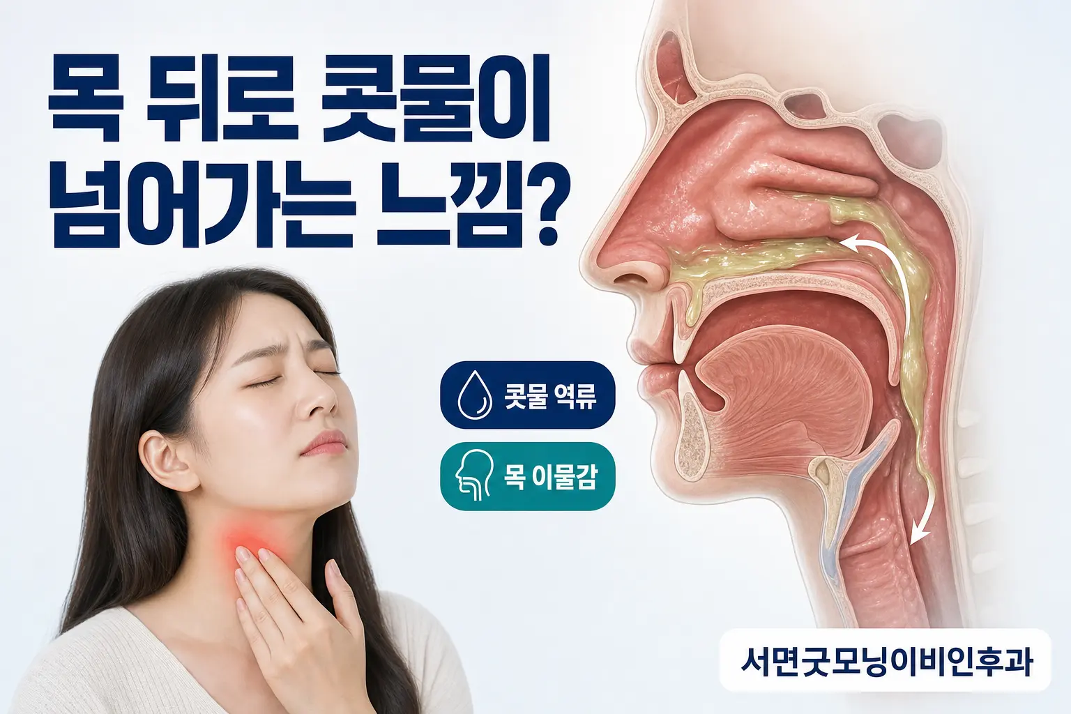 부산이비인후과 | 목 뒤로 콧물이 넘어가는 느낌은 왜 생길까요?