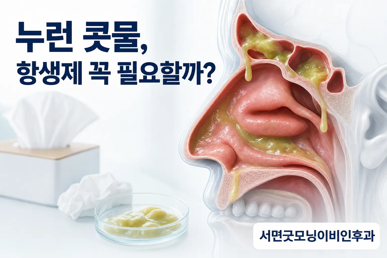 부산이비인후과 | 감기 뒤 누런 콧물은 모두 항생제가 필요할까요?