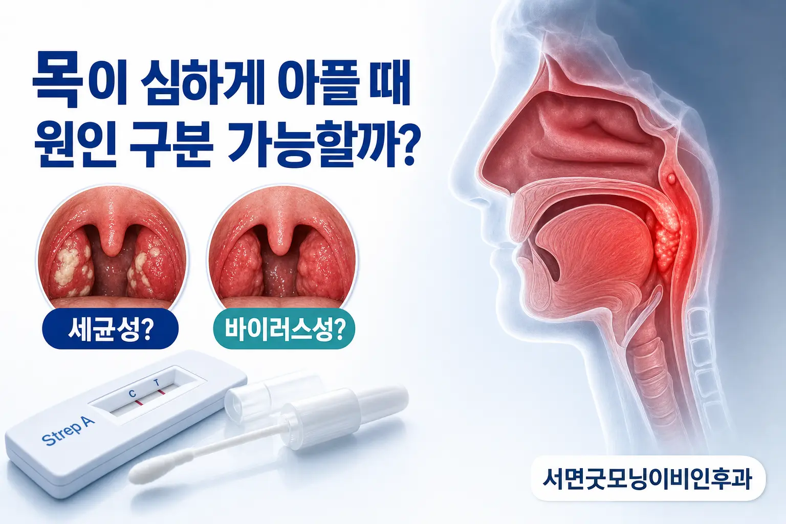 부산이비인후과 | 목이 심하게 아플 때 바이러스와 세균성 편도염을 구분할 수 있을까요?