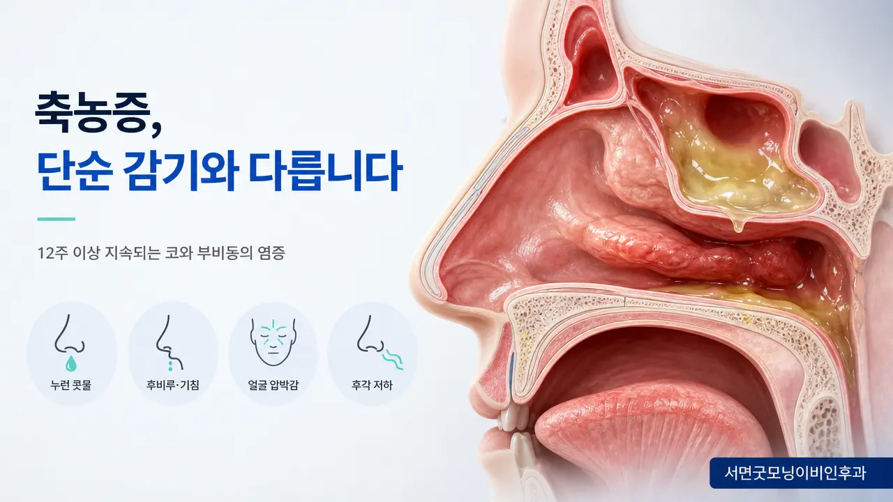 부산이비인후과 | 축농증은 단순 코감기와 어떻게 다를까요?