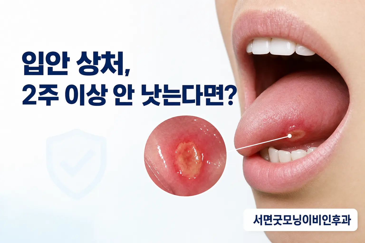 부산이비인후과 | 입안 상처가 2주 이상 낫지 않을 때 확인할 점