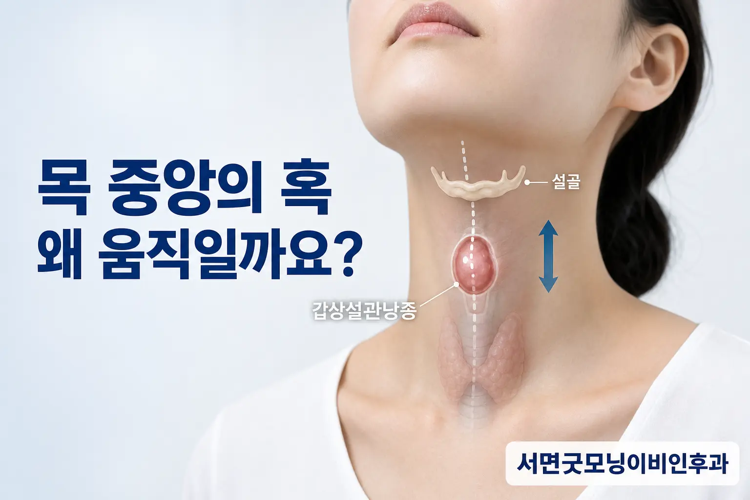 부산이비인후과 | 목 중앙의 혹인 갑상설관낭종은 왜 움직일까요?