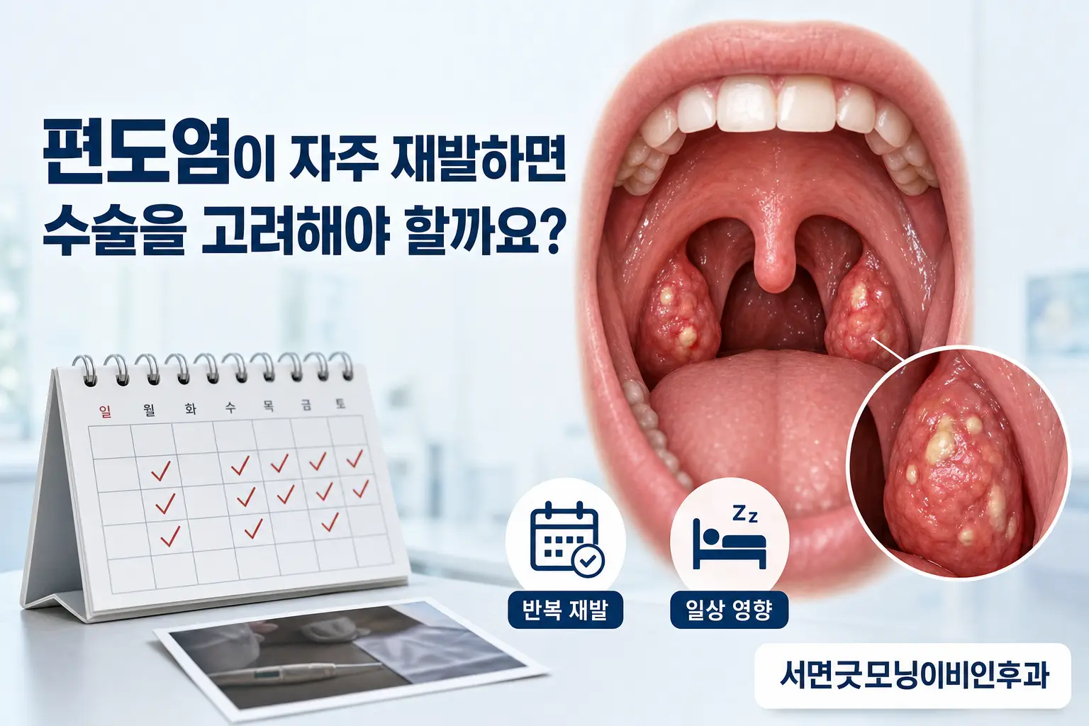 부산이비인후과 | 편도염이 자주 재발하면 수술을 고려해야 할까요?
