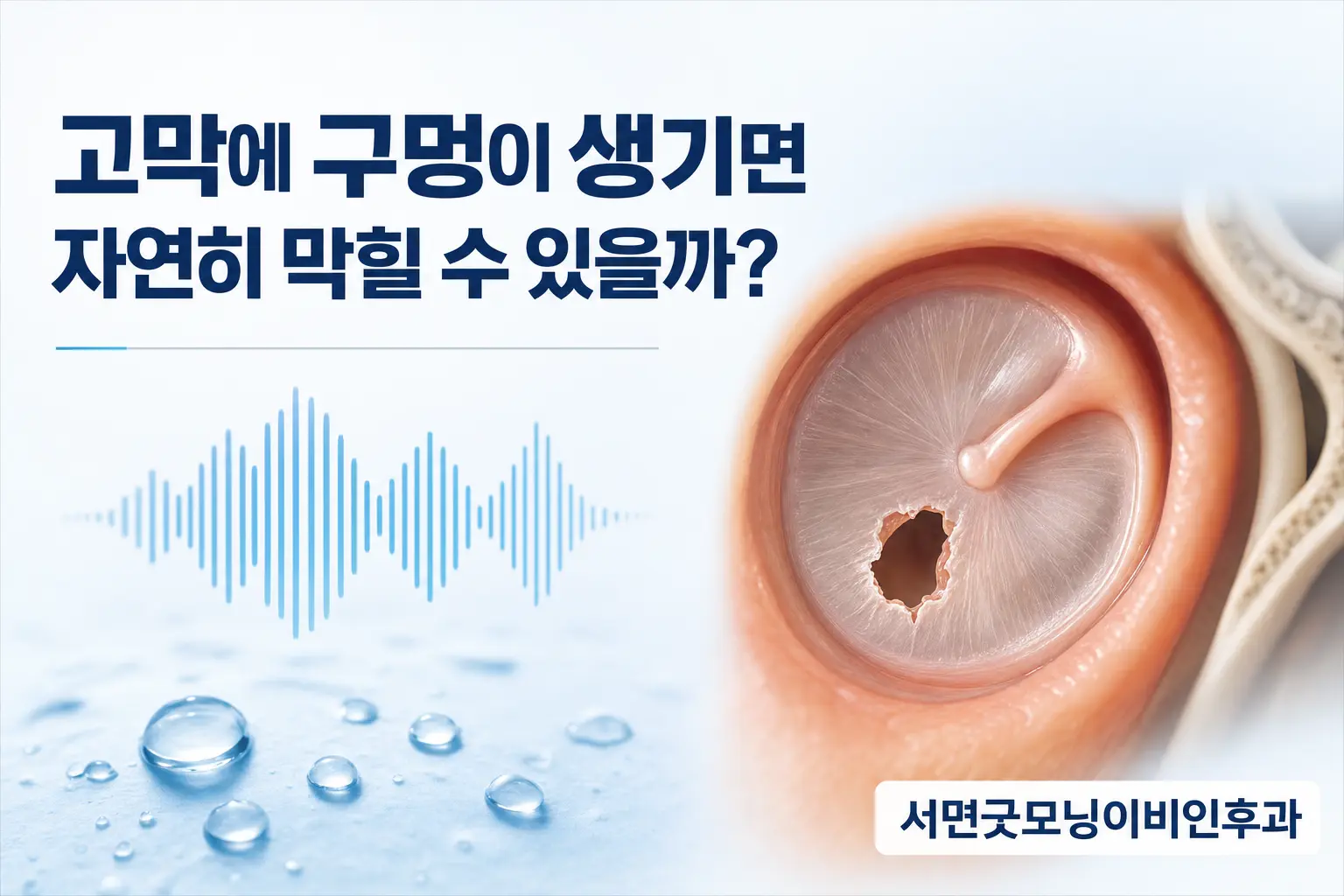 부산이비인후과 | 고막에 구멍이 생기면 자연히 막힐 수 있을까요?