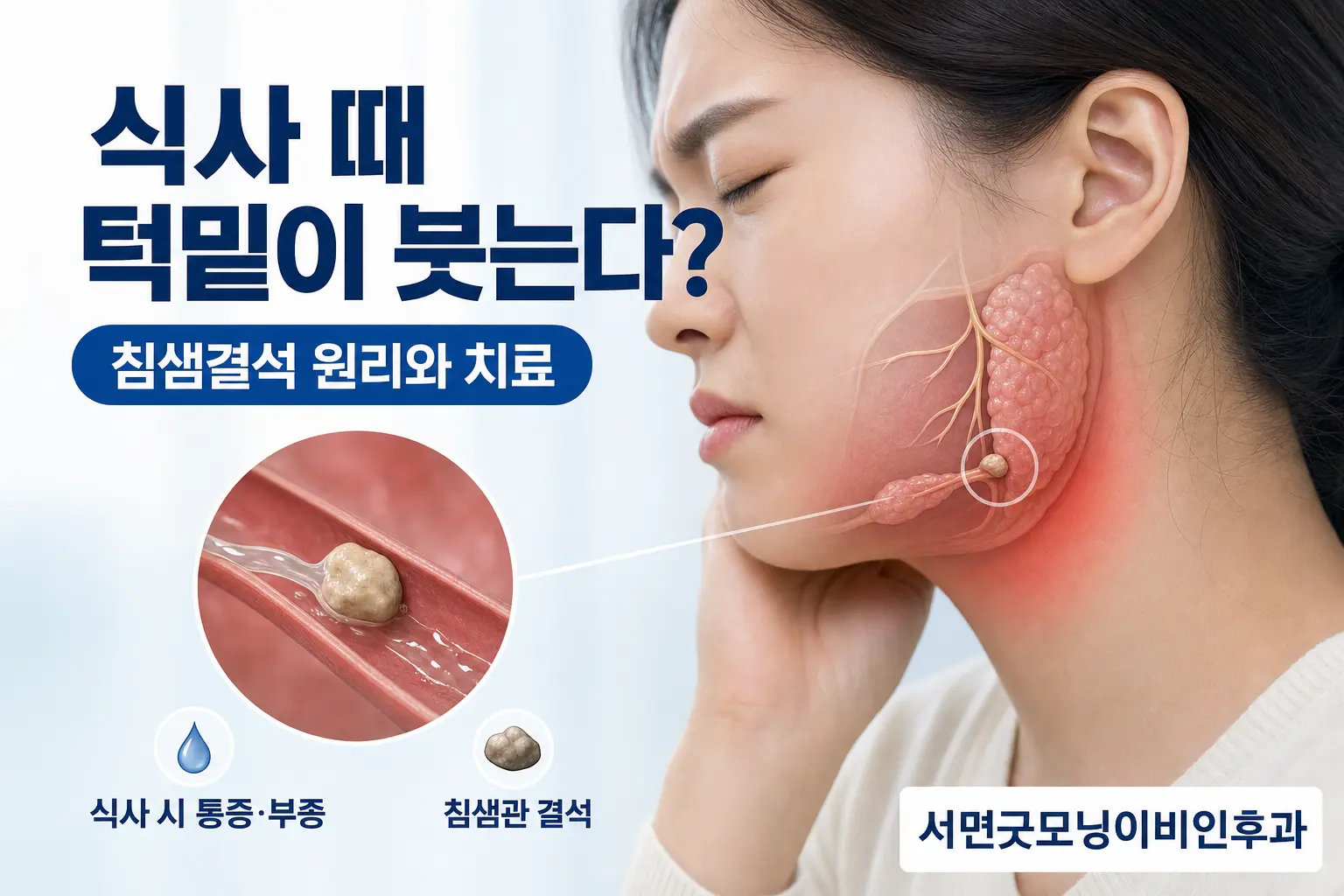 부산이비인후과 | 식사할 때 턱밑이 붓는 침샘결석의 원리와 치료
