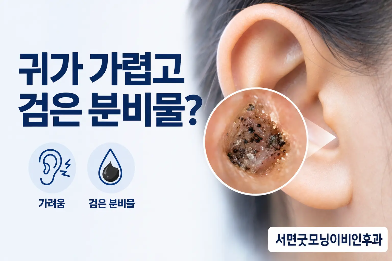 부산이비인후과 | 귀가 가렵고 검은 분비물이 보이는 이진균증
