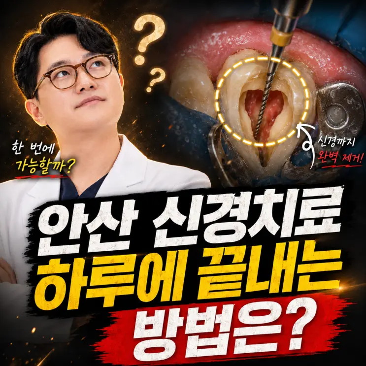 [안산 신경치료] 하루에 끝내는 신경치료 방법은?