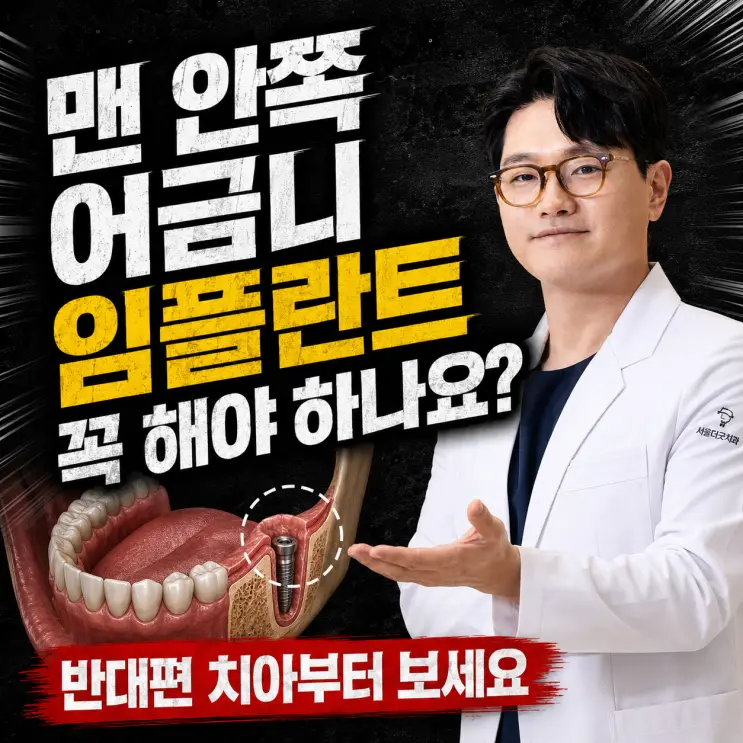 개봉동임플란트| 맨 안쪽 어금니 임플란트 꼭 해야하나요?