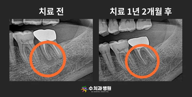 📸 치료 전후 비교 사진