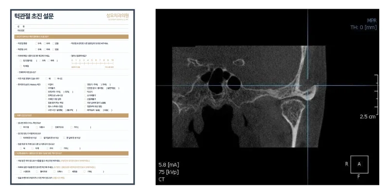 성모치과의원 3D CT 정밀 진단 화면