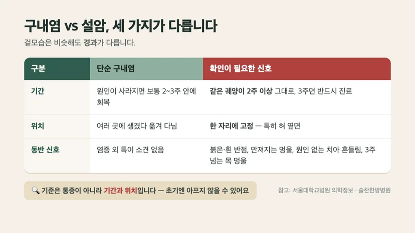 구내염 vs 설암 감별 3가지 — 기간, 위치, 동반 신호 비교표