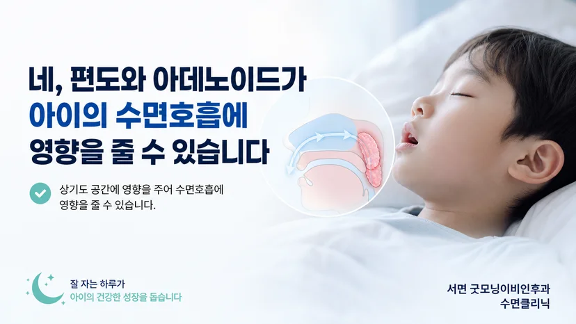 편도와 아데노이드가 소아 수면호흡에 미치는 영향을 설명하는 대표 이미지