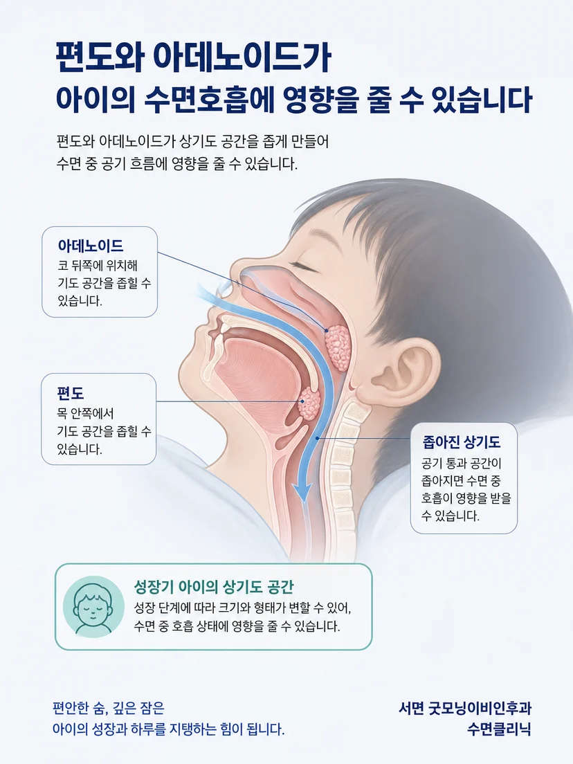 편도와 아데노이드 주변의 소아 상기도 공간을 설명하는 해부 이미지