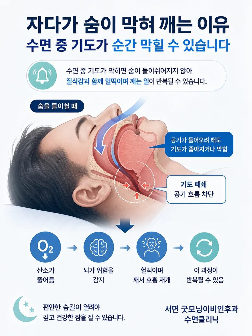 폐쇄성 중추성 혼합성 수면무호흡의 차이를 구분해 설명하는 이미지