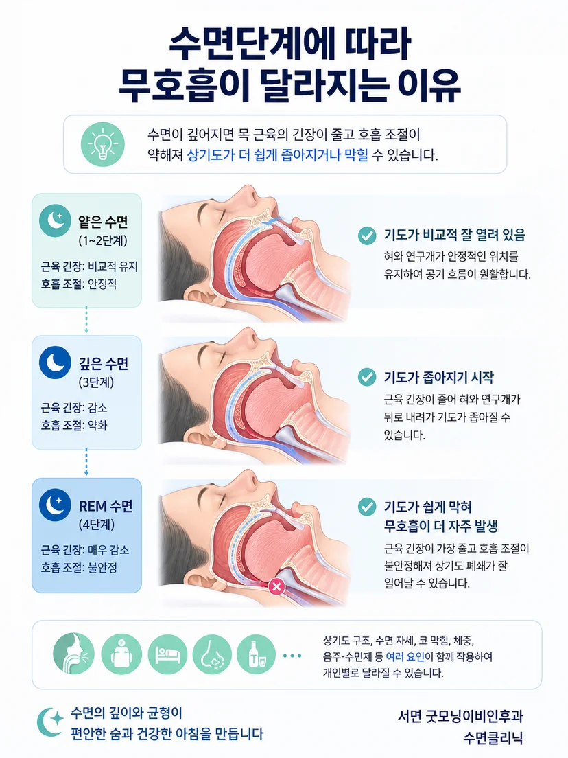 혀와 연구개 위치 및 상기도 단면이 수면단계에 따라 변하는 설명