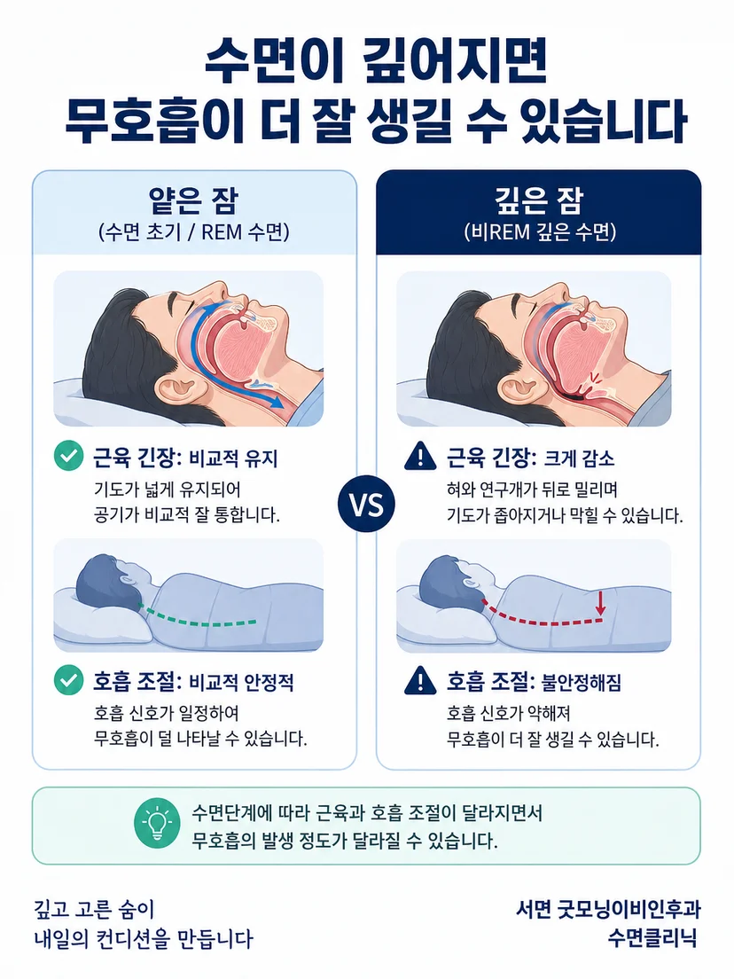 바로 누운 자세에서 혀와 연구개가 뒤로 이동해 상기도가 좁아지는 모습
