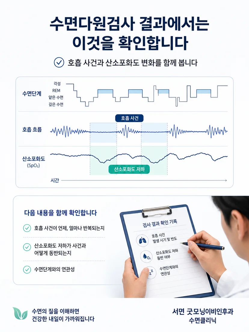 수면다원검사에서 ODI와 호흡 사건 및 수면단계를 함께 평가하는 과정