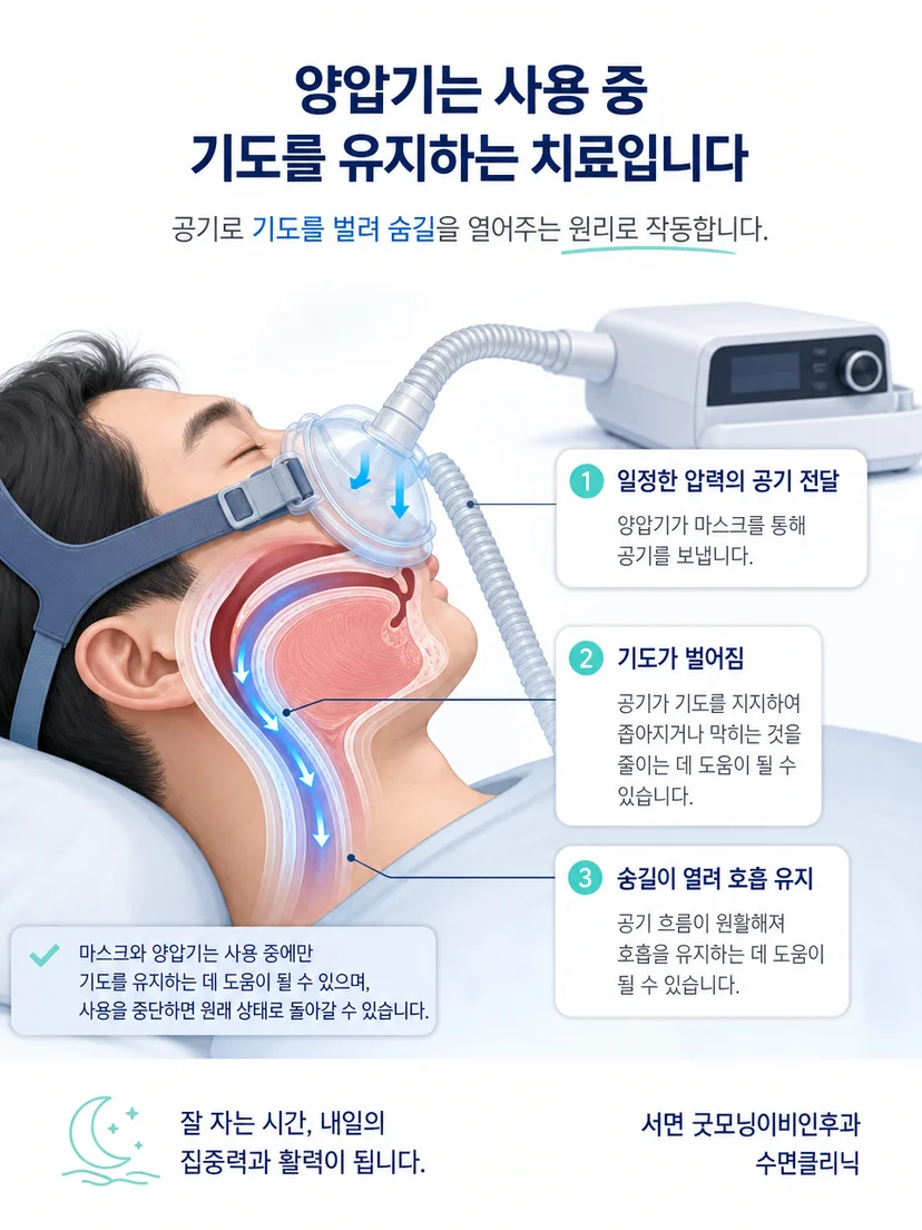 양압기 본체와 호스 및 마스크를 통해 기도에 공기가 전달되는 구조