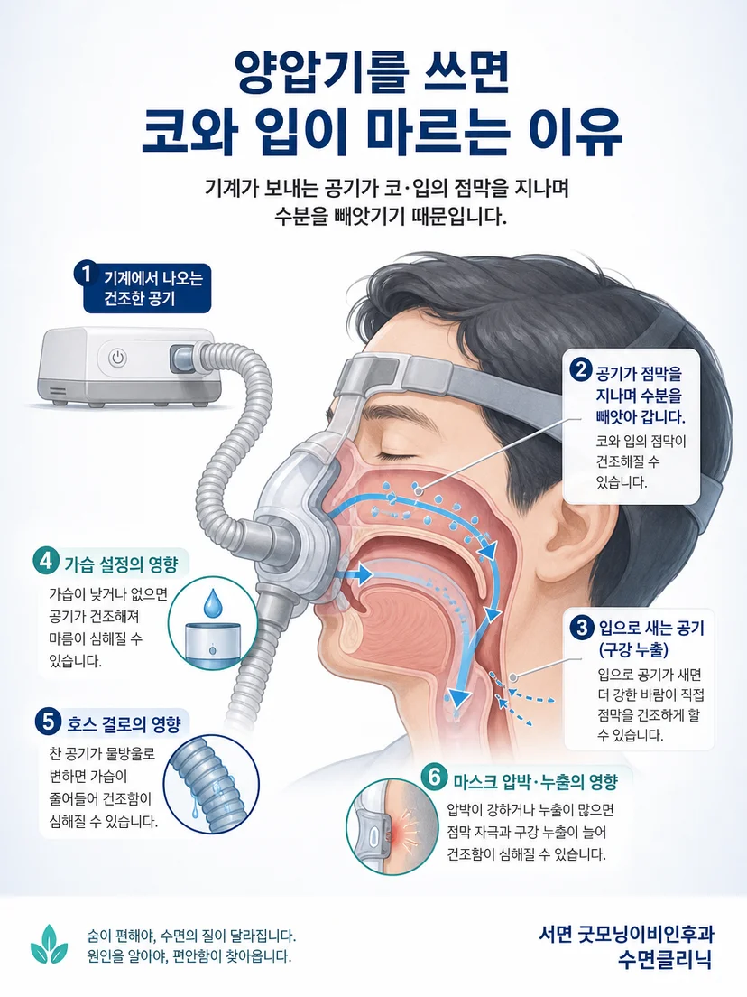 양압기 공기 흐름과 구강 누출이 건조감을 만드는 과정
