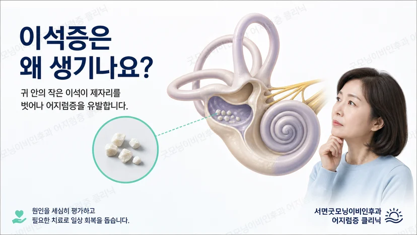 이석증이 생기는 원인과 재발 평가 원칙을 설명하는 핵심 안내