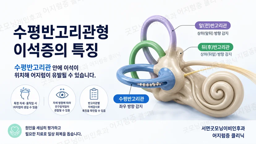 수평반고리관형 이석증의 자세 유발 어지럼과 수평 안진 핵심 설명