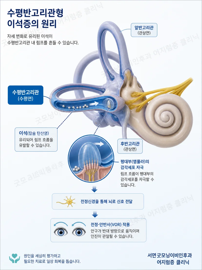 수평 앞 뒤 세 반고리관의 공간 방향을 보여주는 3차원 내이 도식