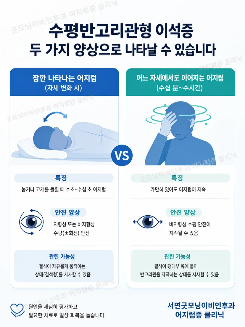수평 자세검사에서 지향성 안진과 비지향성 안진을 구분하는 핵심 그림