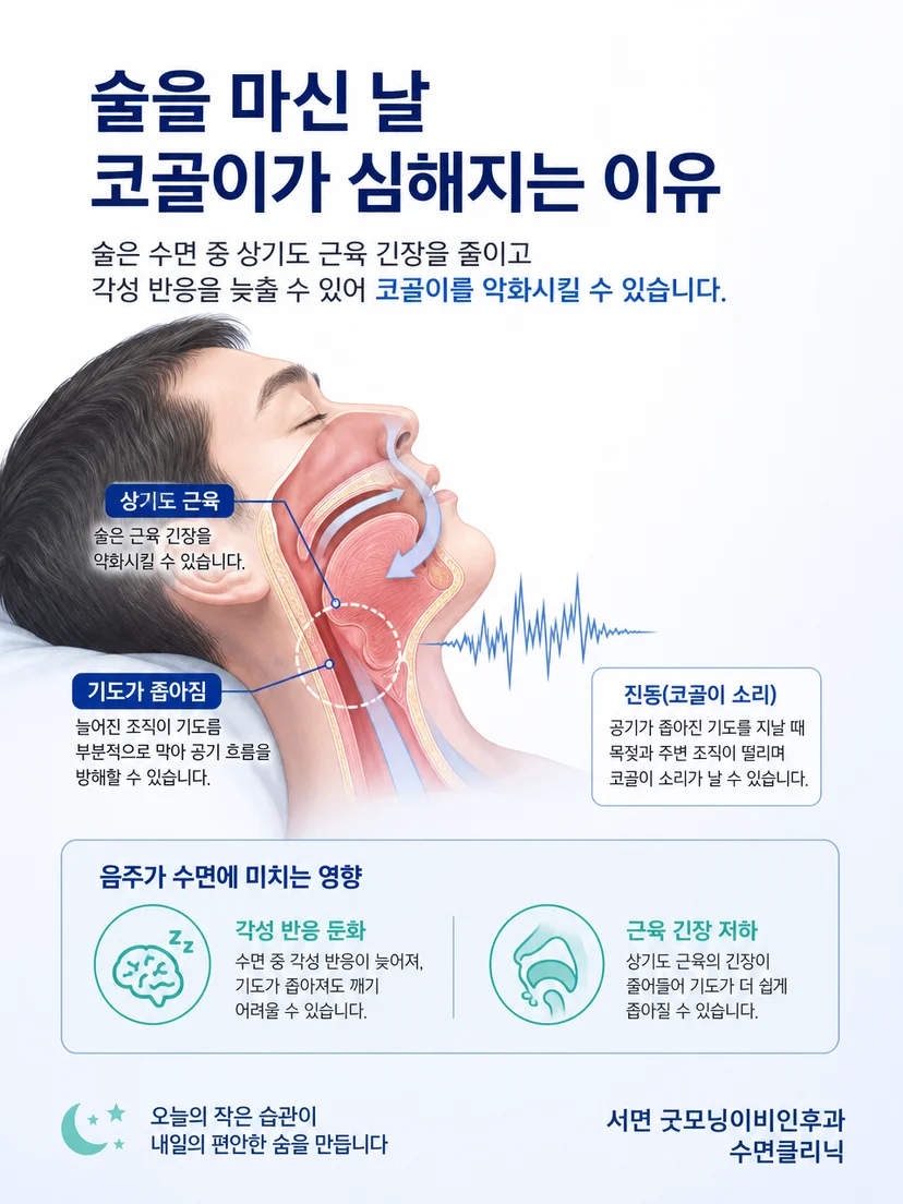 알코올이 수면 중 상기도 근육 긴장과 조직 진동에 미치는 영향