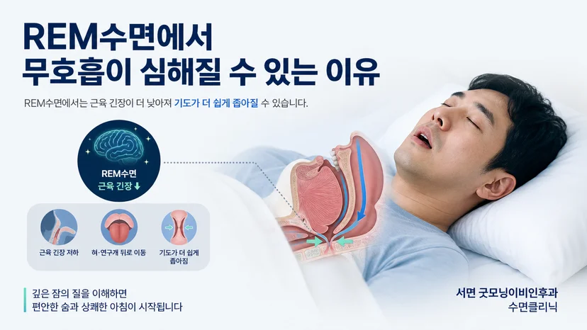 REM수면 중 상기도 근육 긴장 저하와 무호흡 악화를 설명하는 대표 이미지