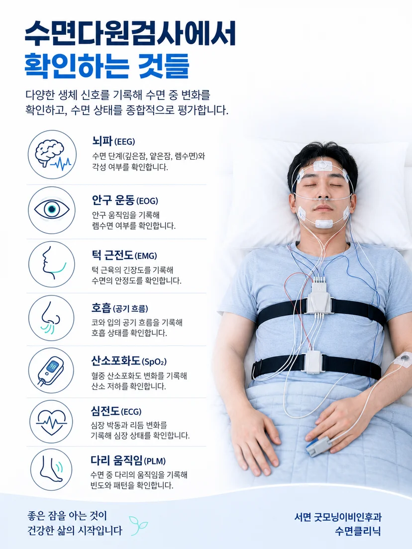 수면다원검사에서 호흡벨트와 여러 생체 신호를 함께 기록하는 이미지
