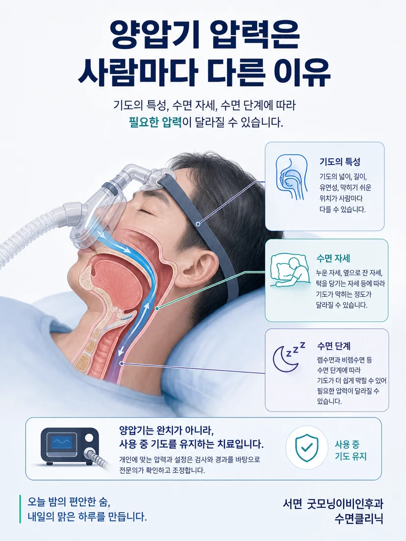 수면 중 좁아진 기도를 양압으로 유지하는 원리를 설명하는 이미지