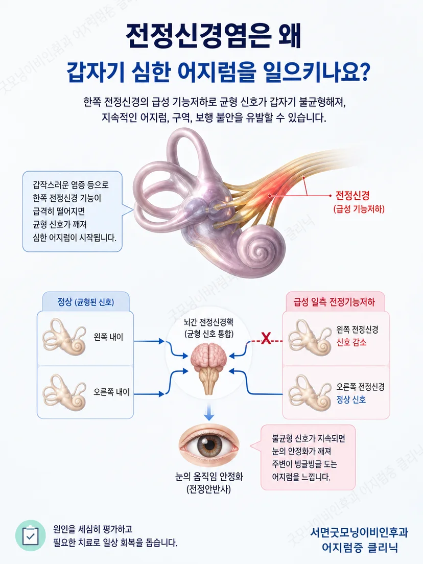 양쪽 전정기관의 신호 불균형이 뇌에 전달되는 과정