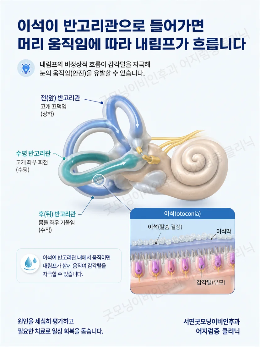 앞반고리관 뒤반고리관 수평반고리관의 공간 방향을 보여주는 삼차원 내이 도식