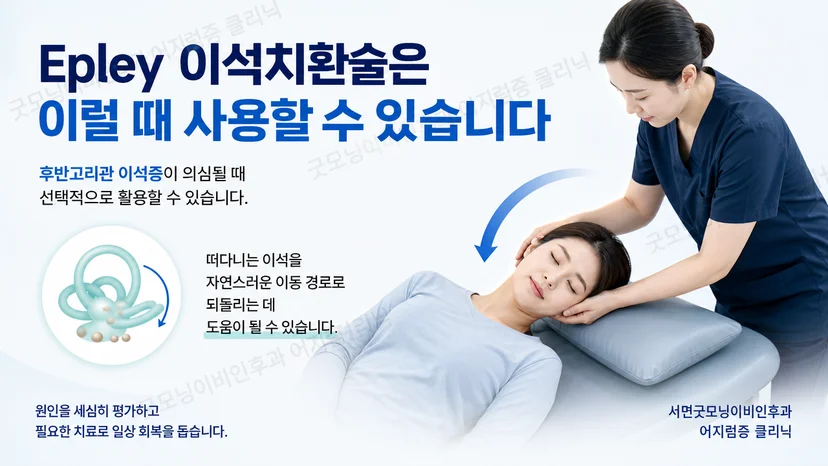 Epley 이석치환술의 적용 조건을 설명하는 핵심 안내 이미지