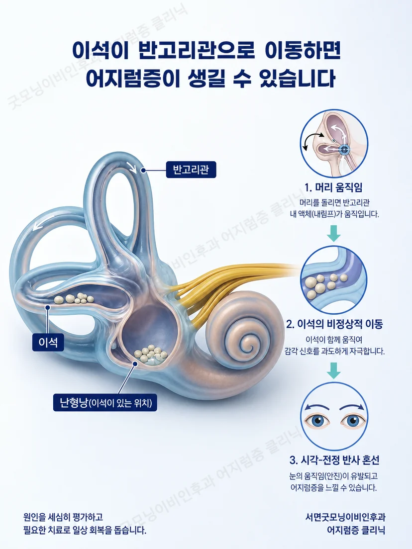반고리관 위치와 단계별 자세 변화의 원리를 설명하는 그림