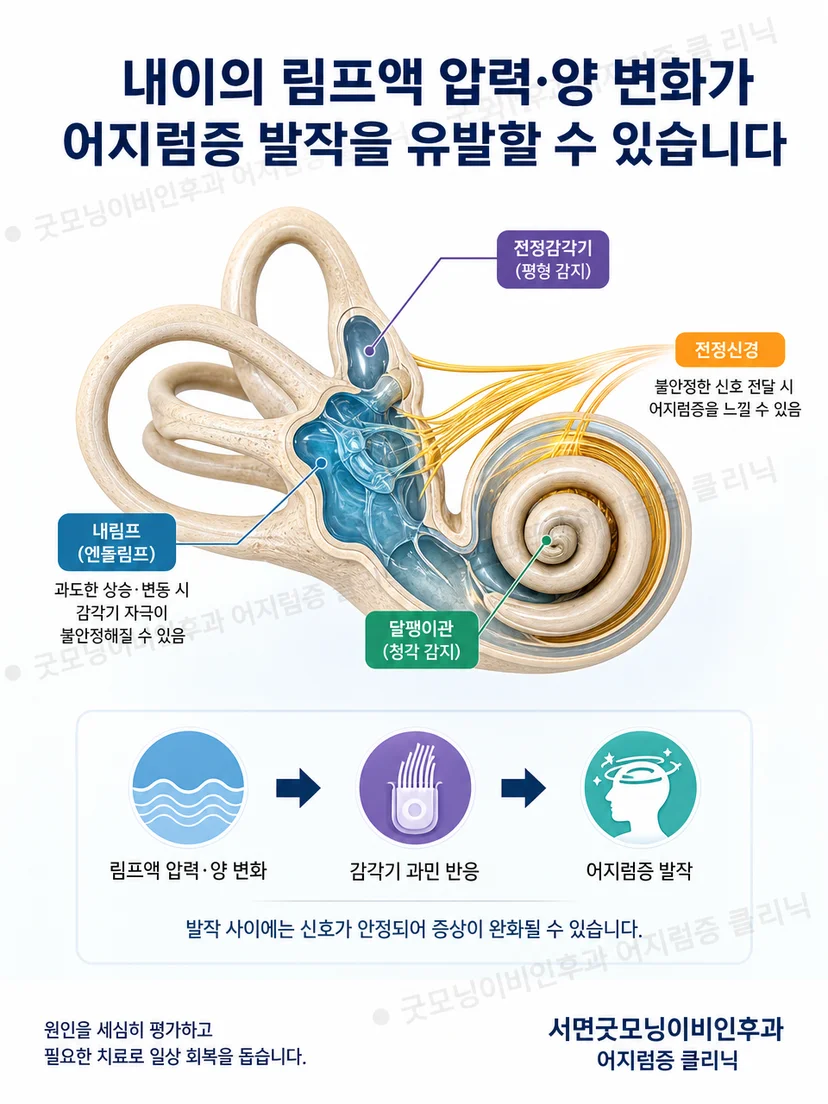 메니에르병에서 청각과 평형 기능 변화가 증상으로 이어지는 개념