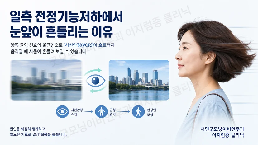 일측 전정기능저하에서 머리 움직임에 따라 시야가 흔들리는 원리를 설명하는 그림
