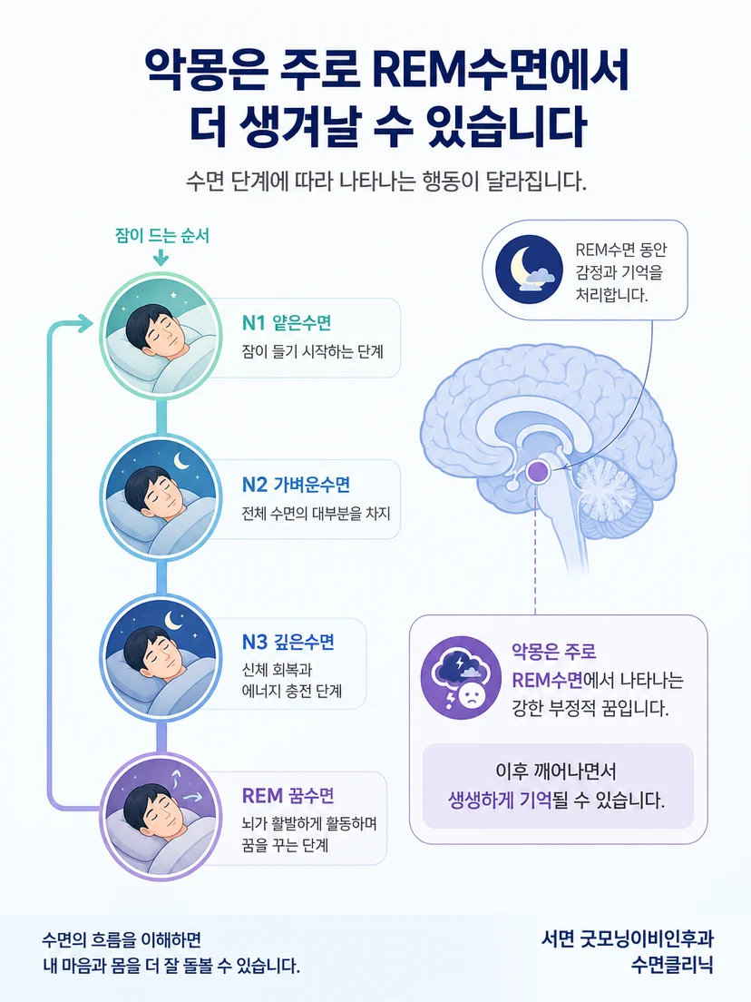 수면 단계와 꿈 및 수면 중 행동의 차이를 설명하는 이미지
