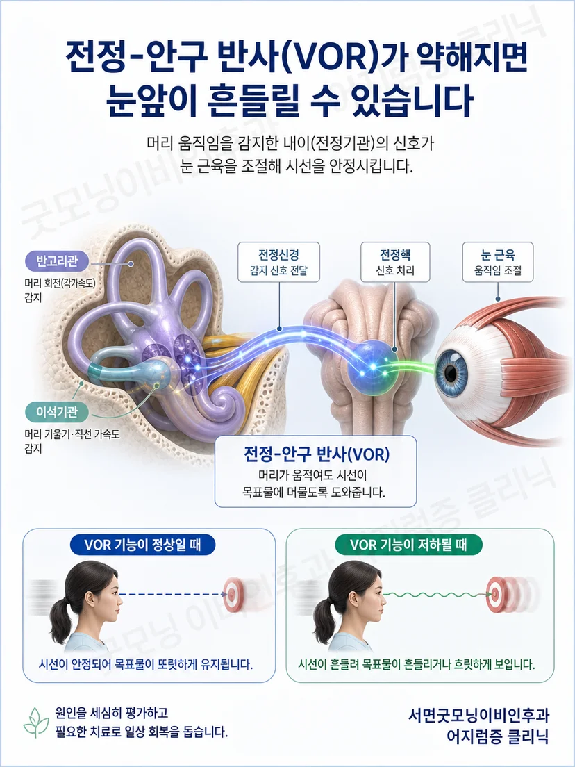 전정안반사가 머리 움직임에 맞춰 눈을 반대 방향으로 움직이는 원리 그림