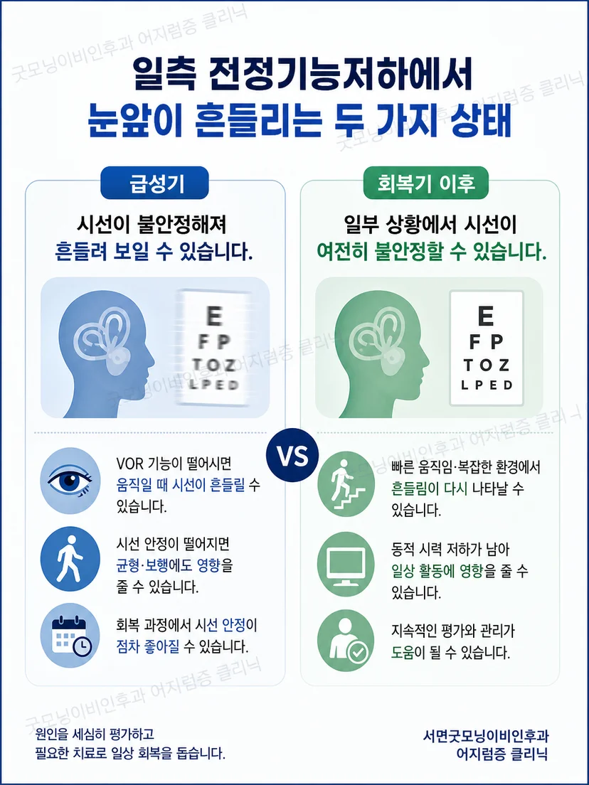 움직임 중 시야 불안정과 자세 변화에 따른 회전감을 구분하는 설명 그림
